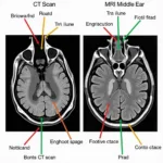 Diagnostic Tools, Middle Ear CT Scan, MRI, and Medicare/BCBSMN Coverage